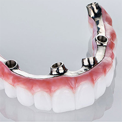 Hàm phủ trên Overbar